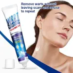 Wart Remover Ointment | Natural Treatment for Warts, Corns & Calluses