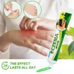 Eczema Cream | Dermatitis, Psoriasis & Anti-Itch Antibacterial Treatment